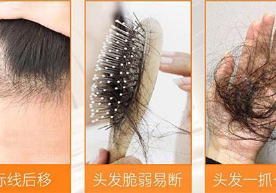 女人掉頭發需要補什么，女人掉頭發缺的6種營養原創