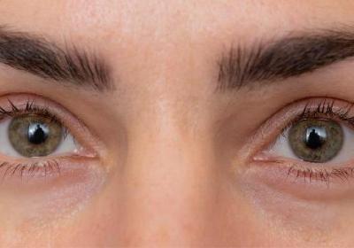 玻尿酸去黑眼圈做完要多久時(shí)間