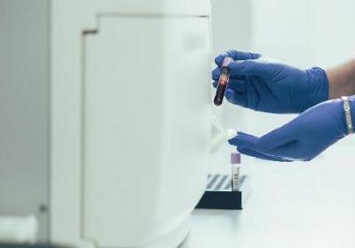 進行血常規(guī)檢查時注意事項