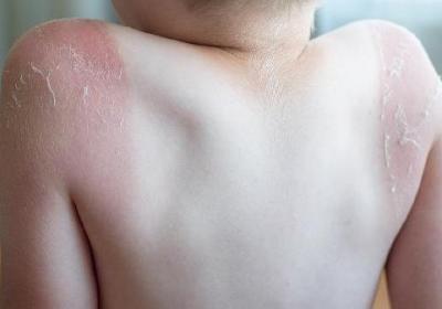 見紅不痛大概多久會生