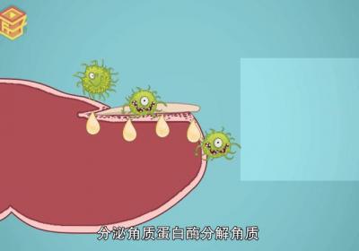 ?小孩會不會有灰指甲 小孩兒會不會得灰指甲