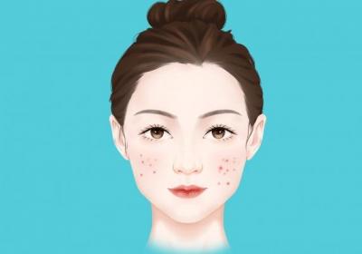 臉上長痘怎么調理