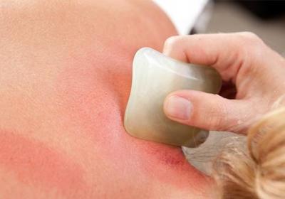 做完烤瓷牙還需注意日常的護理